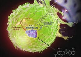 提出基于胆固醇代谢调控的肿瘤免疫治疗新要领