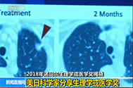 【新闻直播间】2018年诺贝尔心理学或医学奖揭晓：美日科学家分享心理学或医学奖